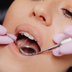 Zrozumieć piaskowanie zębów